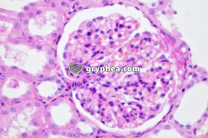 Glomérule Rein Singe x160 - gryphea.com